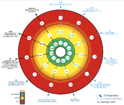 Vektrodiagramm