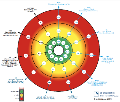 Vektrodiagramm