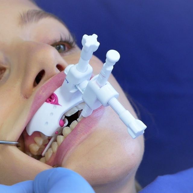 SleepLikeMe-Medical GmbH & Co.KG JS-Gauge hilft Zahnarzt