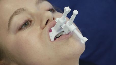 SleepLikeMe-Medical GmbH & Co.KG JS-Gauge im Mund