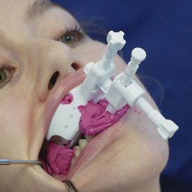 SleepLikeMe-Medical GmbH & Co.KG JS-Gauge Zahnbehandlung