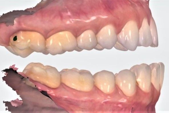 Gebiss 3D
